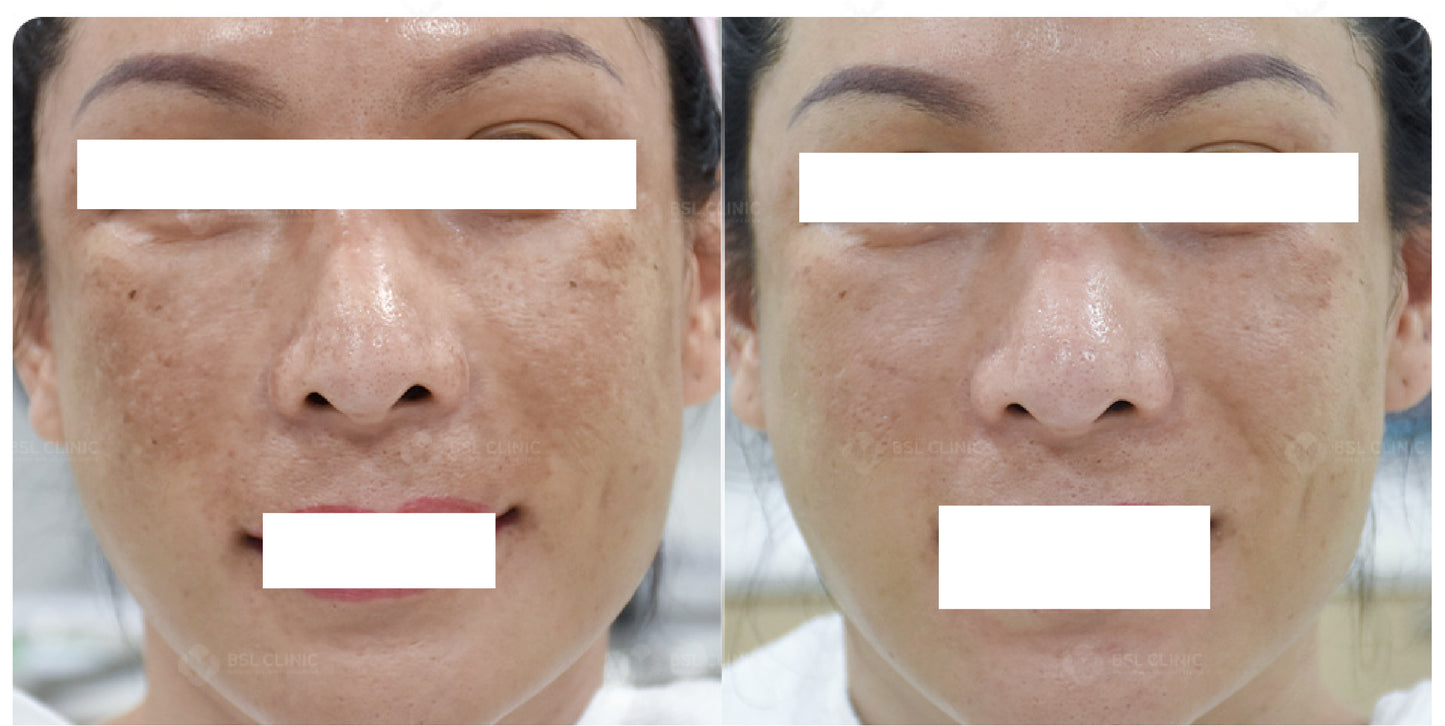 CELLANCE+ Cell Repairing Infusion Ampoules